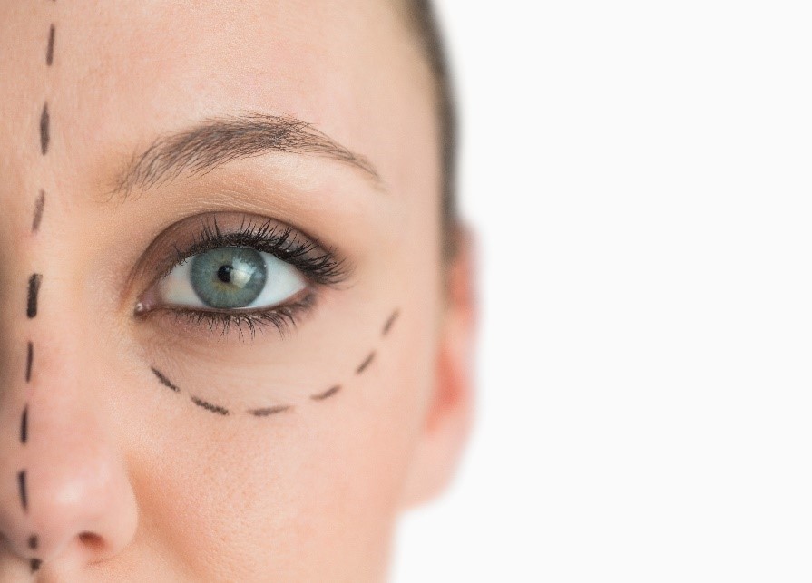 Eyelid Surgery in Philadelphia, PA