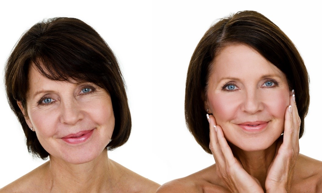 Facial Plastic Surgery in Philadelphia, PA