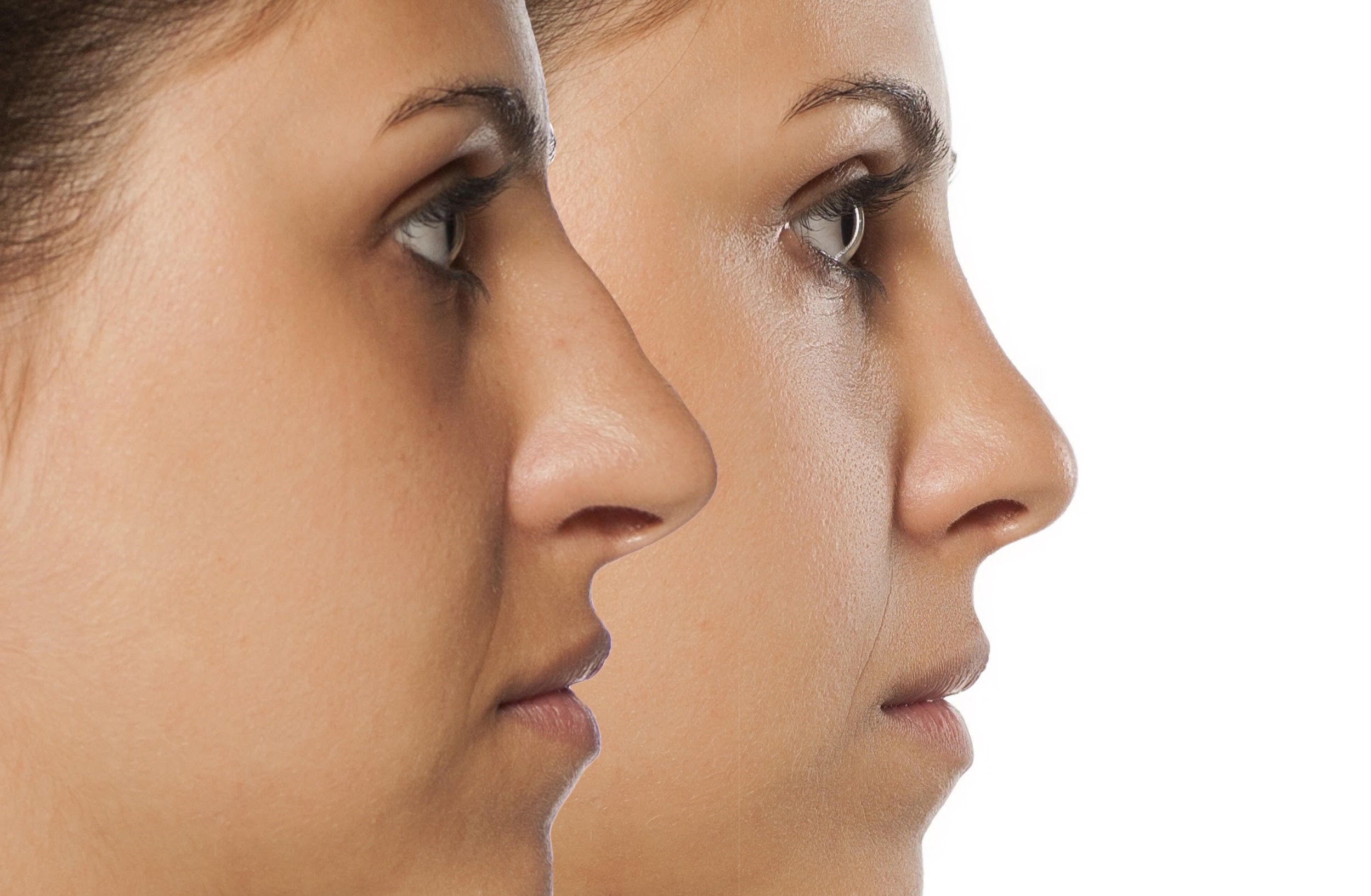 The Rhinoplasty Clinic in Philadelphia, PA