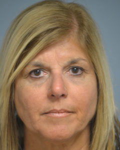 Blepharoplasty Before and After Pictures Philadelphia, PA