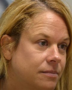 Skin Cancer Reconstruction Brow Lift Before and After Pictures Philadelphia, PA