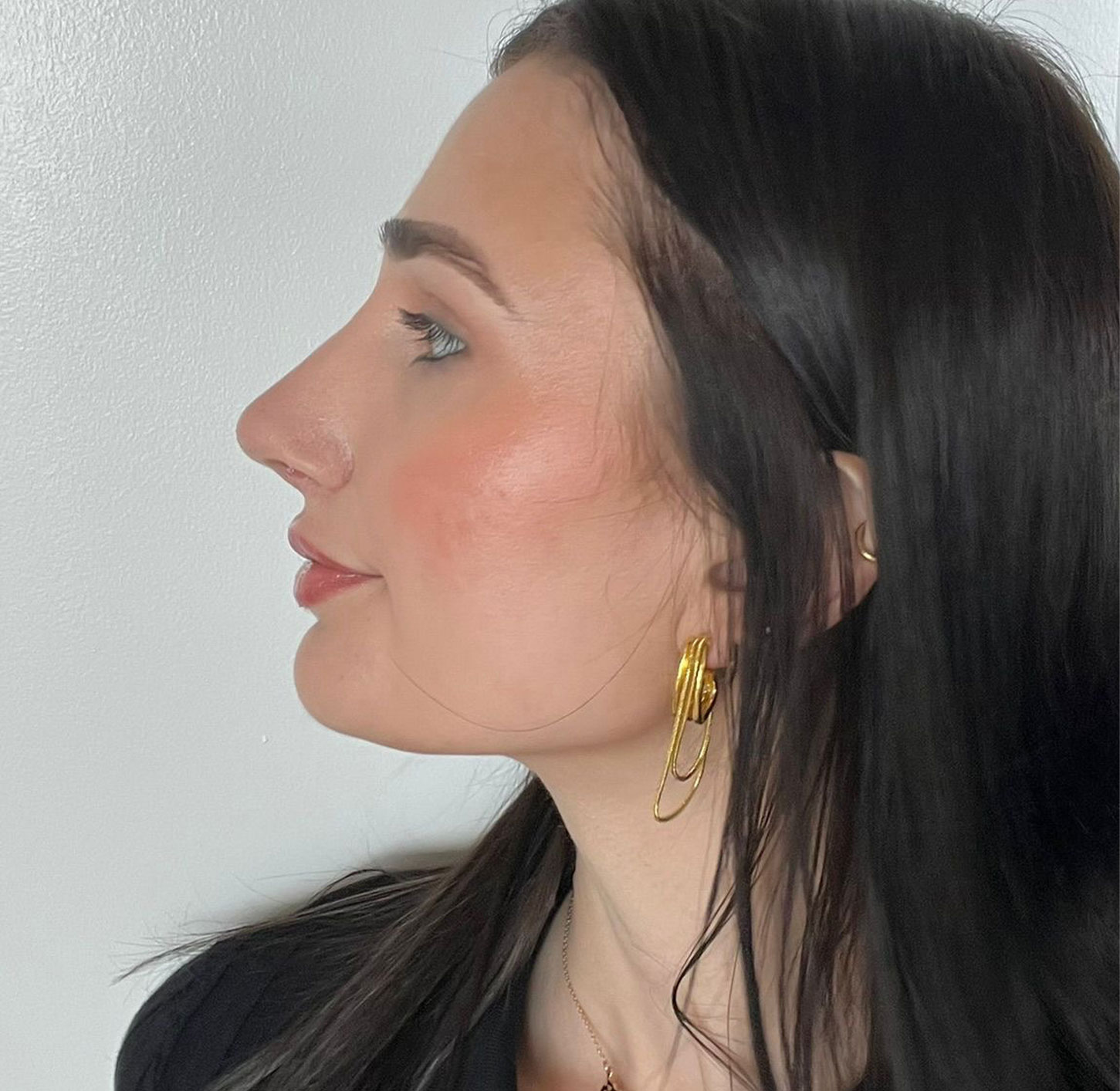 Vollure™ in Philadelphia, PA