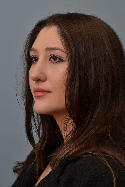 Plastic Surgery in Philadelphia, PA